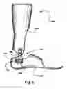 Fig. 06 - Flexion control ankle joint with spherical hinge