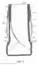 Fig. 04 - ANKLE GUARD AND BRACE SEGMENT FOR THE ANKLE GUARD