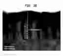 Fig. 46 - Methods And Devices For Fractional Ablation Of Tissue For Substance Delivery