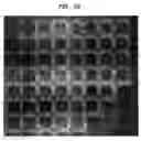 Fig. 55 - Methods And Devices For Fractional Ablation Of Tissue For Substance Delivery