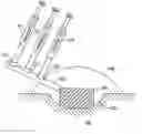 Fig. 01 - Systems and methods for providing a debriding wound vacuum