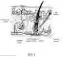 Fig. 02 - APPARATUS AND METHOD FOR SELECTIVE TREATMENT OF TISSUE