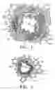 Fig. 02 - BIPOLAR DEVICES FOR MODIFICATION OF AIRWAYS BY TRANSFER OF ENERGY