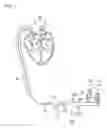Fig. 02 - PFO closing device