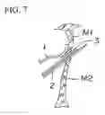 Fig. 07 - PFO closing device