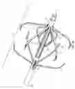 Fig. 02 - Percutaneous permanent retrievable vascular filter