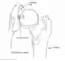 Fig. 01 - Method and apparatus for re-attaching the labrum of a hip joint