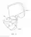 Fig. 06 - Method and apparatus for re-attaching the labrum of a hip joint