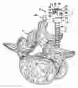 Fig. 01 - Surgical retaining screw