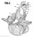 Fig. 02 - Surgical retaining screw