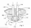 Fig. 02 - Prosthetic Intervertebral Discs Having Folding End Plates That Are Implantable By Minimally Invasive Surgical Techniques