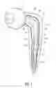 Fig. 02 - Antibiotic bone cement spacer