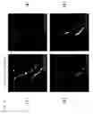Fig. 09 - Method of analyzing cell or the like having linear shape, method of analyzing nerve cell and apparatus and program for performing these methods