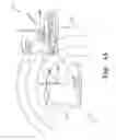 Fig. 05 - Ultrasonic multilateration system for stride vectoring
