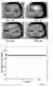 Fig. 09 - System and method for imaging with extended depth of focus and incoherent light