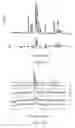 Fig. 02 - MAGNETIC NANOPARTICLES OF HYDROXYAPATITE AND PREPARATION METHOD THEREOF