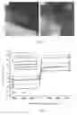 Fig. 06 - MAGNETIC NANOPARTICLES OF HYDROXYAPATITE AND PREPARATION METHOD THEREOF