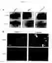 Fig. 02 - Products and methods for treating PTP lar diseases