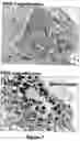 Fig. 08 - Isolation of adult multipotential cells by tissue non-specific alkaline phosphatase