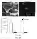 Fig. 06 - Compositions and methods for treating sphingosine-1-phosphate (S1P) related ocular diseases and conditions