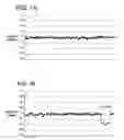 Fig. 02 - METHODS AND SYSTEMS FOR THE DETECTION OF MICRODELETION AND MICRODUPLICATION SYNDROMES