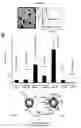 Fig. 12 - Method for treating a brain cancer with ifenprodil