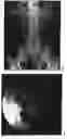 Fig. 01 - Enterically coated cystamine, cysteamine and derivatives thereof