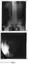 Fig. 02 - Enterically coated cystamine, cysteamine and derivatives thereof