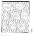 Fig. 02 - Polymer containing calcium sulfate particles for bone augmentation