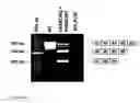 Fig. 07 - Modulation of exon recognition in pre-mRNA by interfering with the secondary RNA structure