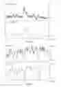 Fig. 02 - Method and device for predicting abnormal medical events and/or assisting in diagnosis and/or monitoring, particularly in order to determine depth of anesthesia
