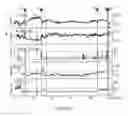 Fig. 04 - Method and device for predicting abnormal medical events and/or assisting in diagnosis and/or monitoring, particularly in order to determine depth of anesthesia