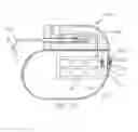Fig. 09 - Implantable electro-optical sensor