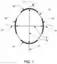 Fig. 02 - Composite electrode