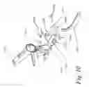 Fig. 12 - Integrated imaging workstation and a method for improving, objectifying and documenting in vivo examinations of the uterus