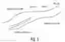 Fig. 04 - Ultrasonic Diagnostic System With Flexible Examination Protocols and Report Generation