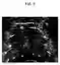 Fig. 06 - LINEAR WAVE INVERSION AND DETECTION OF HARD OBJECTS