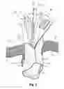 Fig. 03 - Ambidextrous ankle support