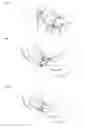 Fig. 02 - Medical Device with Protected Transcutaneous Device