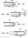 Fig. 22 - METHODS FOR MAINTAINING THE PATENCY OF  COLLATERAL CHANNELS IN THE LUNGS USING CRYO-ENERGY