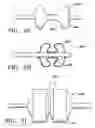 Fig. 35 - METHODS FOR MAINTAINING THE PATENCY OF  COLLATERAL CHANNELS IN THE LUNGS USING CRYO-ENERGY