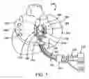 Fig. 02 - Cardiac treatment devices and methods