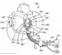 Fig. 01 - Conduction block verification probe and method of use