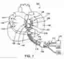 Fig. 02 - Conduction block verification probe and method of use