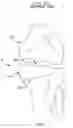 Fig. 02 - Method and apparatus for reconstructing a ligament and/or repairing cartilage, and for performing an open wedge, high tibial osteotomy