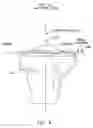 Fig. 06 - Method and apparatus for reconstructing a ligament and/or repairing cartilage, and for performing an open wedge, high tibial osteotomy