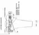 Fig. 22 - Method and apparatus for reconstructing a ligament and/or repairing cartilage, and for performing an open wedge, high tibial osteotomy