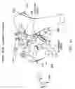 Fig. 35 - Method and apparatus for reconstructing a ligament and/or repairing cartilage, and for performing an open wedge, high tibial osteotomy