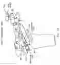 Fig. 44 - Method and apparatus for reconstructing a ligament and/or repairing cartilage, and for performing an open wedge, high tibial osteotomy