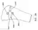 Fig. 53 - Method and apparatus for reconstructing a ligament and/or repairing cartilage, and for performing an open wedge, high tibial osteotomy